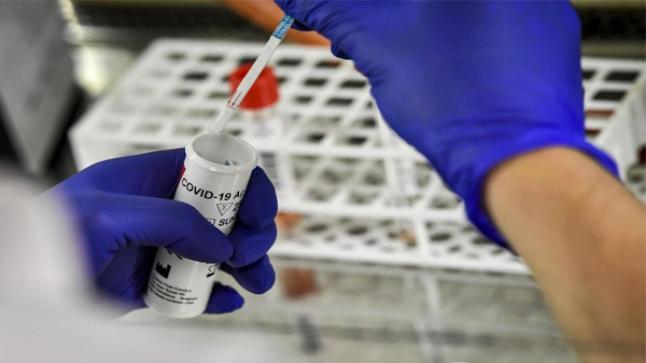 المملكة المغربيةسجلت 451 إصابة مؤكدة جديدة بفيروس خلال 24 ساعة